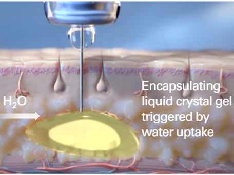 Subcutaneous Administration of FluidCrystal prefilled Injection and the initiation of the encapsulation