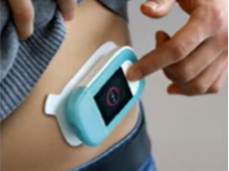 Subcutaneous Pump
